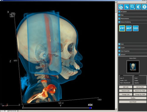 Módulo de software para imágenes médicas - iQ-3D - IMAGE Information Systems - de visualización 3D / de postprocesamiento / para tablet PC