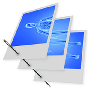 Software para imagen ortopédica - Stitching  - IMAGE Information Systems - para imagen veterinaria / de gestión de datos / de adquisición