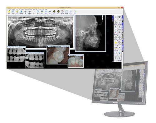 Software para imagen dental - LED Dental - para odontología / de visualización / de análisis