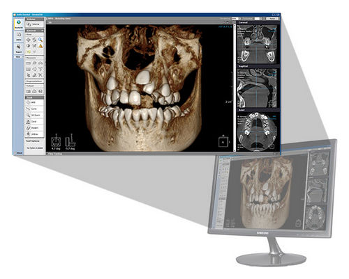 Software de visualización 3D - Xelis 3D - LED Dental - de análisis / para imagen dental / para odontología