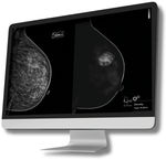 software para tomosíntesis mamaria