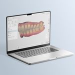 software para esc&aacute;ner intraoral