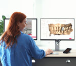 sistema CAO/FAO para pr&oacute;tesis dentales
