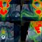 software TDMFusion Technology™Hermes Medical Solutions, Inc