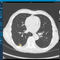software de análisisVAREX Imaging