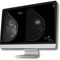 software para tomosíntesis mamariaBreast-SlimView&reg;Hera-MI