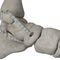 pr&oacute;tesis de ligamento tend&oacute;n tibial posteriorInfinity-Lock&reg;Neoligaments