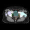 plataforma de IA médicaVarian Oncology