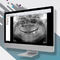 software de visualizaci&oacute;nOMSCarestream Dental