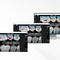 software de visualizaci&oacute;nPearl's Second Opinion&reg;Carestream Dental