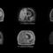 software de simulaci&oacute;n4D MR-RTPhilips Healthcare