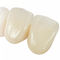 pr&oacute;tesis dental de circonaPrimeIvoclar Vivadent