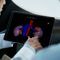 software de planificaci&oacute;nIntuitive Intuitive Surgical