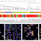 software médicoStratoMineR™Molecular Devices