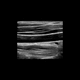 software para ecografía / de mejora de la imagen