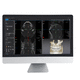 software TDM / para imagen dental / para odontología / de análisis