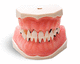 modelo anatómico de dientes / de encías / para periodoncia / de formación