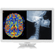 monitor quirúrgico / para endoscopia / de laparoscopia / Full HD