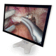monitor médico / 1920 x 1080 / 23,8