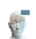 implante impreso en 3D / facial / anatómico / de PEEK