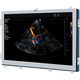 monitor para ecografía / 1280 x 1024 / 19