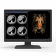 monitor de diagnóstico / de radiología / 30