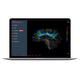 software para IRM / para imagen cerebral / para MRI functional / para neurocirugía