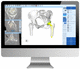 software de hospital / TDM / para cirugía de la cadera / de análisis