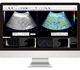 software para ecografía / clínico / de visualización / de diagnóstico