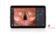 procesador de vídeo para endoscopia / con monitor de vídeo / para imágenes en Full HD