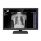 monitor médico / de diagnóstico / para imágenes médicas / de radiología