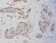 reactivo en solución / para inmunohistoquímica / de marcadores tumorales / del ratón