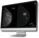 software para tomosíntesis mamaria / de análisis / de interpretación / para detección del cáncer de mama