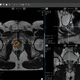 software para detección del cáncer de próstata / médico / para PACS / de gestión