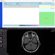 RIS procesos basados en la web / para informes / de visualización DICOM / para imágenes médicas