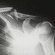 software de análisis de imágenes / de detección de fracturas / médico / de hospital