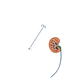 vaina de acceso ureteral / renal / orientable / atraumática