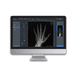 software de adquisición / de tratamiento / de radiografía / Windows