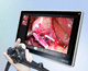 grabadora de vídeo con conversión de ficheros DICOM / de diagnóstico / con pantalla táctil / 4K