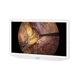 monitor 4K / quirúrgico / para sala de operaciones / para imágenes médicas