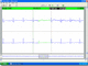 software médico / para Holter cardíaco / de monitorización / de análisis