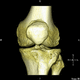 software de anatomía / para cirugía ortopédica / de creación de prótesis de rodilla