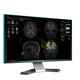 software médico / para IRM / para MRI functional / de análisis