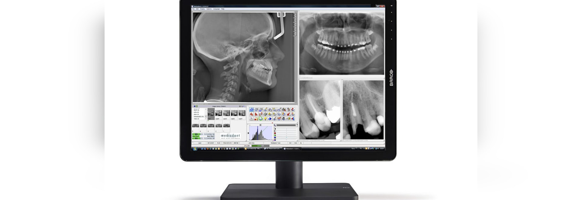 NUEVO color 2MP del NIO de Barco: La mejor ergonómica de la visión y la conformidad completa con el estándar del estruendo 6868-157