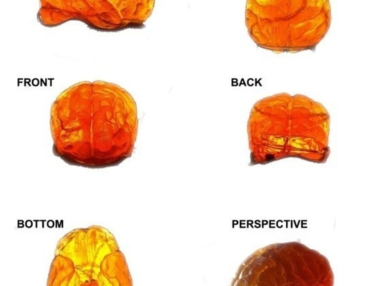 Fantasma/MRI/cerebro de la prueba de la proyección de imagen del ultrasonido