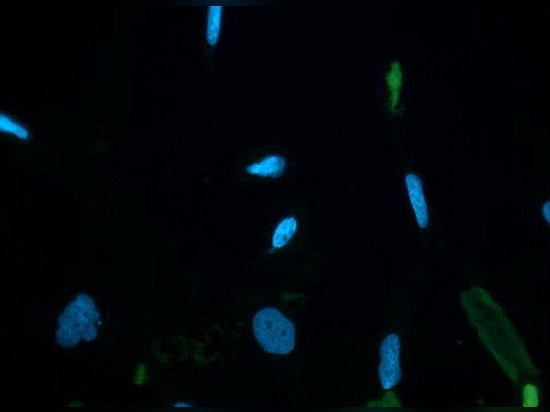 Célula nerviosa manchada por DAPI