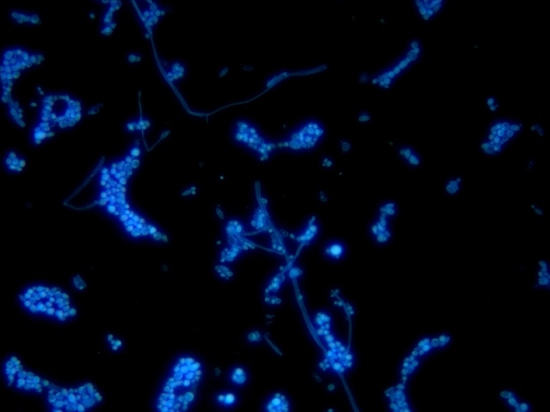 Fungis debajo del microscopio de fluorescencia