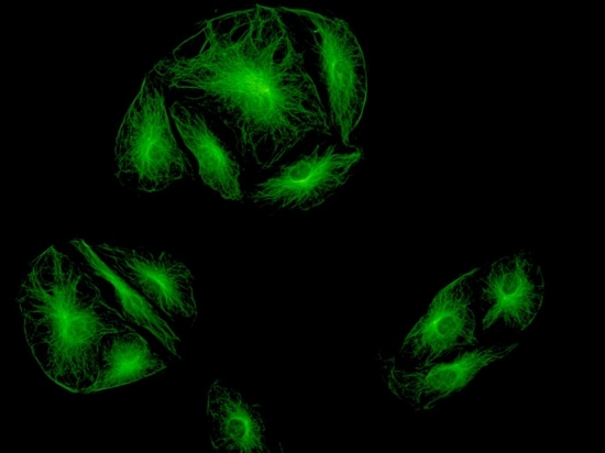 Tinte de células por FITC bajo microscopio de fluorescencia