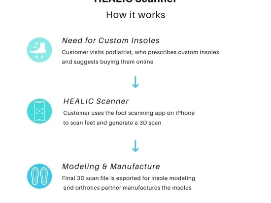 Sistema de escaneo basado en LIDAR ReTiSense para ortesis personalizadas de alta precisión