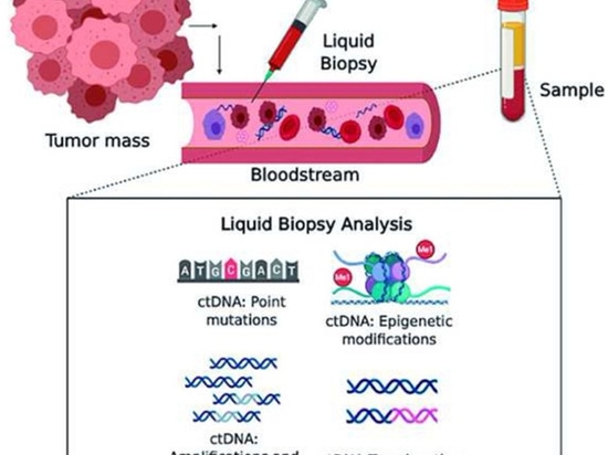 ¿Qué son las técnicas de biopsia líquida?